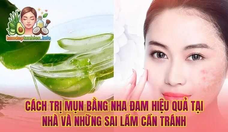 Cách trị mụn bằng nha đam hiệu quả tại nhà và những sai lầm cần tránh