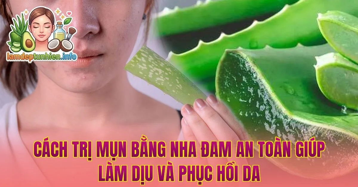 Cách trị mụn bằng nha đam an toàn giúp làm dịu và phục hồi da