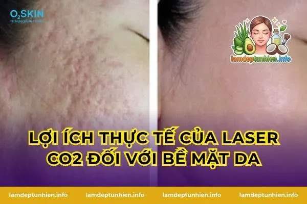 Lợi ích thực tế của laser CO2 đối với bề mặt da