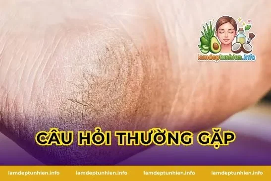 Câu Hỏi Thường Gặp